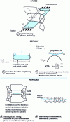 Figure 4 - Profile and flatness defects: some remedies