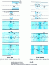 Figure 4 - Finite element calculations – Comparison of thick and thin plate lamination