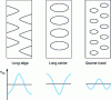 Figure 27 - Main non-developable flatness defects (Crédit Alcan)