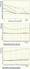 Figure 34 - Compression and decompression curves