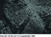 Figure 41 - Electron micrograph of a eutectoid structure