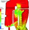Figure 4 - Temperature at the filling front. The colors indicate the temperature of the ceramic paste as it passes through a zone for the first time. This allows you to check that the paste won't congeal before the entire part is filled, or to know the temperature when two paste fronts are joined, and thus avoid a crack-type defect.