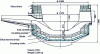 Figure 5 - Acid lining. Masonry of an electric furnace in siliceous refractories