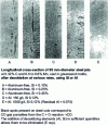 Figure 15 - Controlling deoxidation, porosity caused by the release of CO