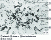 Figure 11 - Iron inclusion in CuZn39Pb1Al brass (after [6])