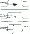 Figure 19 - Aspects of AlSi13 shrinkage in an isolated mass according to the eutectic silicon structure