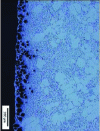 Figure 26 - Subcutaneous porosity resulting from a reaction with the mold's poteyage