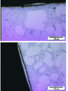 Figure 27 - Examples of eutectic surface layers not welded to the substrate