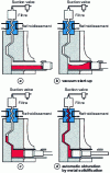 Figure 4 - Example of the use of a massive air draft device connected to a vacuum pump on a cold room machine