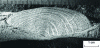 Figure 31 - Mid-thickness fatigue fracture (15 mm) in the tread of a locomotive monoblock wheel. Front lines and radiating protrusions