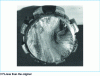 Figure 35 - Fatigue fracture of a 40 mm ∅ primary shaft of a tractor gearbox. Peripheral primers creating a reversal of stop lines in the shrink-fit zone by a ball bearing (from [1])