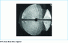 Figure 36 - Alternating bending fatigue fracture of a suspended auger shaft. Numerous machining marks along the lubrication hole and periphery. Final dragonfly-wing fracture. ∅ 70 mm