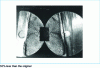 Figure 37 - Complementary alternating bending-torsion fatigue fracture of a ∅ 40 mm axis initiated in a keyway