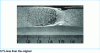 Figure 41 - Streaks near the end of a corrugated tensile fatigue fracture of an 18 mm mild steel plate