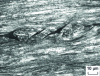 Figure 59 - Axial V-shaped tears on martensitic cores of hard steel wire ∅ 1 mm