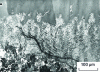 Figure 69 - Crack in the hardened zone of an X120Mn12 steel weld on a hard rail steel (flanged rails). Mixing zone no longer self-hardening