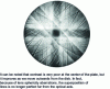 Figure 18 - Kossel silicon cliché according to <001>. [20]