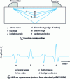 Figure 34 - Principle of defect sizing using the diffraction echo time-of-flight (TOFD) technique (extract from prENV 538-6)