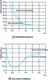 Figure 11 - Numerical study of frictionless indentation by a 70.3˚ taper of a bilayer material : SiC hard film (E = 275 GPa;  GPa) on metal (E = 206 GPa;  GPa (without work hardening) or 1.761  (with work hardening) GPa; H = 2.7 GPa) [18]