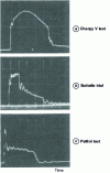 Figure 17 - Comparison of effort-time curve recordings in the transition domain for various tests