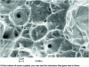 Figure 3 - Fractography of an austenitic stainless steel showing cup-shaped facies