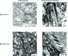 Figure 4 - Martensitic microstructures in carbon steels (IRSID plates)
