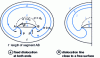 Figure 20 - Source: Frank-Read