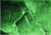 Figure 22 - Dislocations pinned by precipitates, observed by electron microscopy using the weak-beam technique