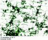 Figure 36 - Example 2 of a dislocation network in silicon-free 18-14 stainless steel