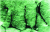 Figure 9 - Dislocation interactions and dissociated nodes in 18-14 stainless steel