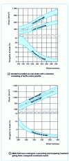 Figure 4 - Relationship between hardness and tensile properties of spheroidal graphite cast irons [9]