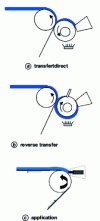 Figure 17 - Possibilities for transferring material to the metal coil