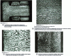 Figure 20 - Minor segregation deformations