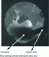 Figure 12 - Observations of the cavity using endoscopy with nozzles (after [14])