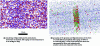 Figure 2 - Observation of aluminum alloy microstructures by atomic tomographic probe