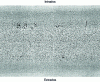 Figure 19 - Example of an intrados crack exceeding the face cracking threshold on an axial longitudinal section of a liquid-core bent slab. [36]