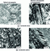 Figure 3 - Martensitic microstructures in carbon steels (IRSID photo)