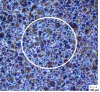 Figure 18 - C60-Nital 4 (light microscopy)