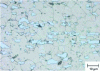 Figure 23 - X190 Cr13 – carbides in a fine martensitic matrix (optical microscopy), Villela etchant