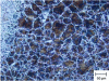 Figure 3 - C60 – Heat-affected zone after welding (optical microscopy)