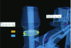 Figure 57 - Dimensional inspection of an aluminum alloy die-cast part (courtesy of Zeiss)