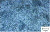 Figure 9 - C100 steel; presence of poorly globulated secondary carbides (optical microscopy)