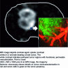 Figure 1 - Comparison of the spatial resolution of images acquired by MRI (grayscale) and two-photon microscopy (color)