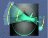 Figure 5 - Schematic displacement of the source-receiver assembly for a conventional orthopantomograph. View from above. During exposure, the system's axis of rotation develops into an ellipse centered on the dental arch.