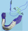 Figure 6 - Geometric distortions created by dental panoramic imaging. During a panoramic examination, all structures located on the inside of the imaged area will be enlarged and blurred, while those located on the outside (vestibular side) will be blurred and diminished.