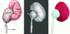 Figure 8 - Comparison between the anatomical drawing of the renal parenchyma, renal pelvis and ureter (left), the virtual model of the simulator (center) and the simulator produced by additive manufacturing (right).