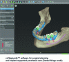 Figure 3 - Illustration of software for treatment planning and surgery