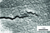 Figure 10 - In situ cracking of a 3Y-TZP zirconia ceramic, observed with a SEM [43].