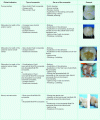 Figure 10 - Use of the different types of composites according to the clinical
indication - examples associated with this classification (source of the illustrations [16])