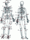 Figure 3 - Multisegmental body modeling; segment definition based on markers placed on anatomical points [31]
